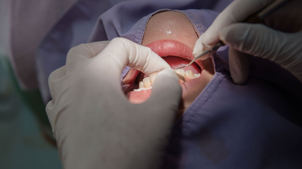 One of our expert dentists fixing a patients tooth.