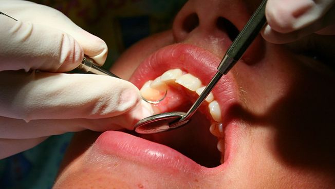 A patient receiving dental treatment.